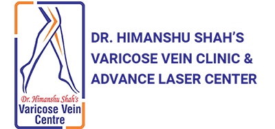 Varicose vein treatment Mumbai | Dr Himanshu Shah
